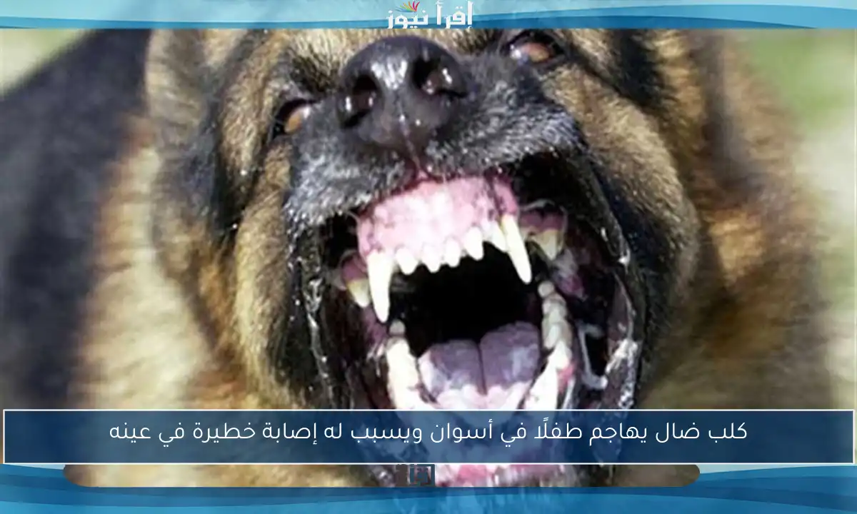 كلب ضال يهاجم طفلًا في أسوان ويسبب له إصابة خطيرة في عينه
