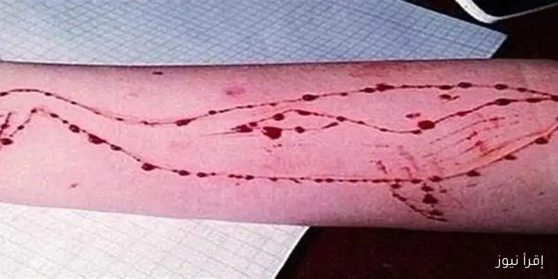 لعبة الحوت الأزرق تودي بحياة طالب آخر في مصر وتزيد من أعداد الضحايا